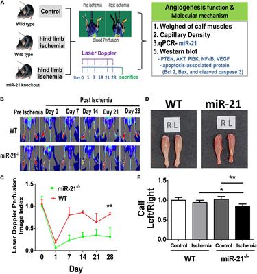 Deletion of MicroRNA-21 Impairs Neovascularization Following Limb Ischemia: From Bedside to Bench